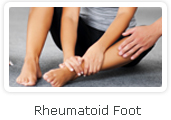 Rheumatoid Foot - Victorian Orthopaedic Foot & Ankle Clinic