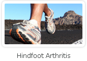 Hindfoot Arthritis - Victorian Orthopaedic Foot & Ankle Clinic